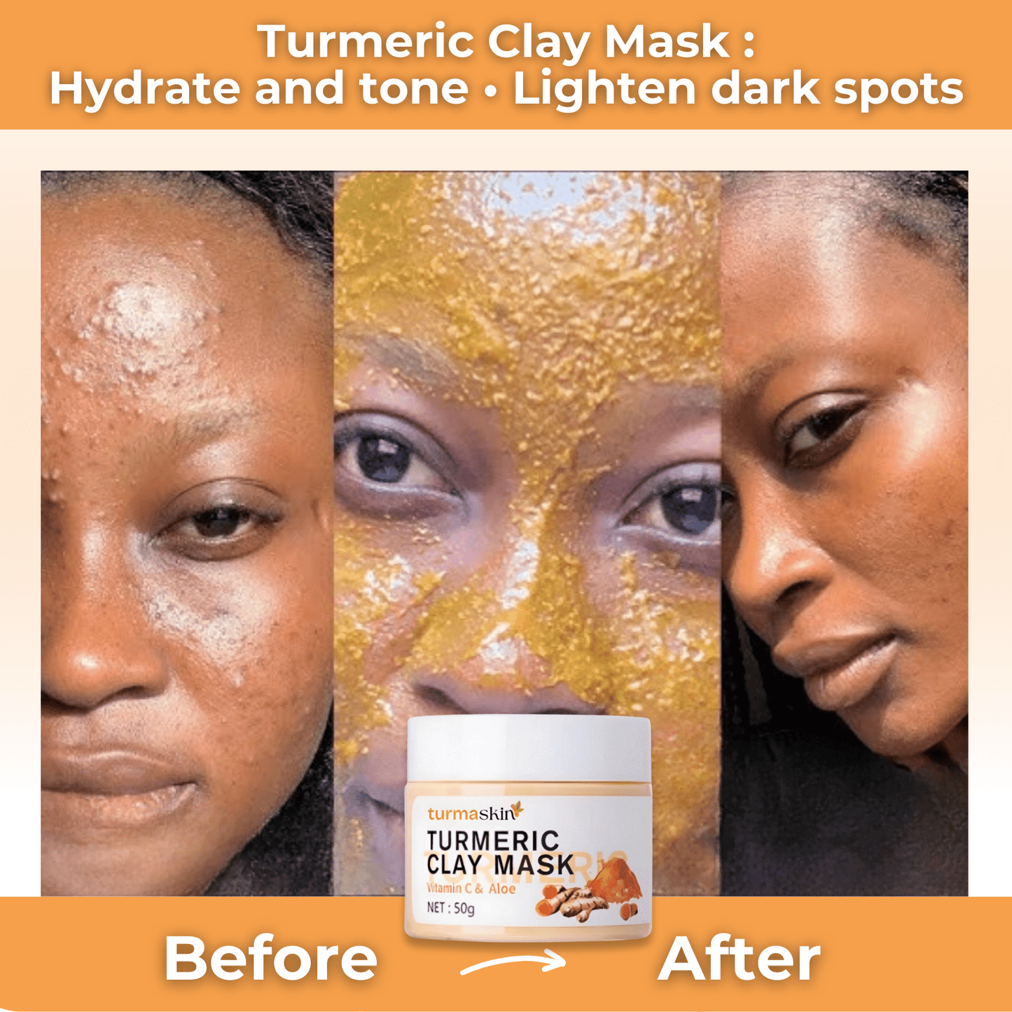 Turmaskin™ Turmeric Clay Mask - Turmaskin