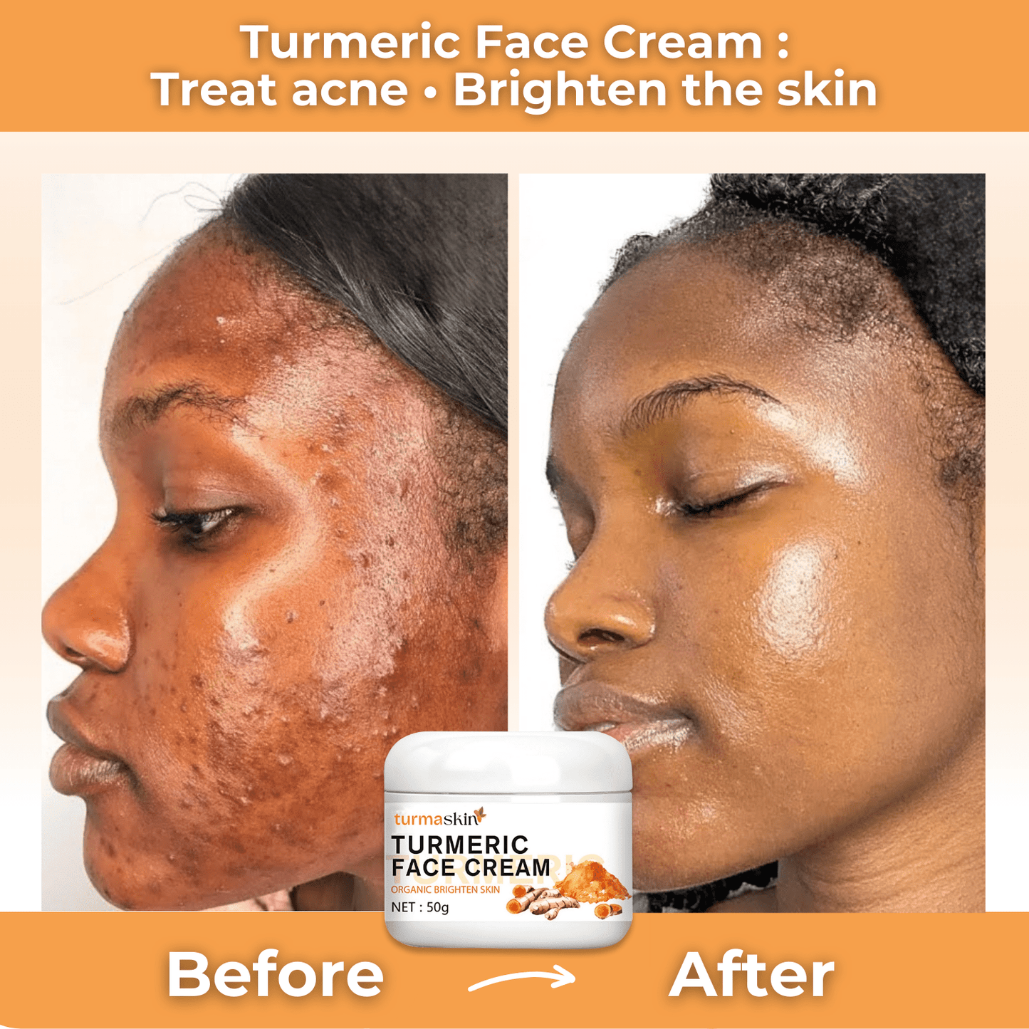 Turmaskin™ Turmeric Face Cream - Turmaskin