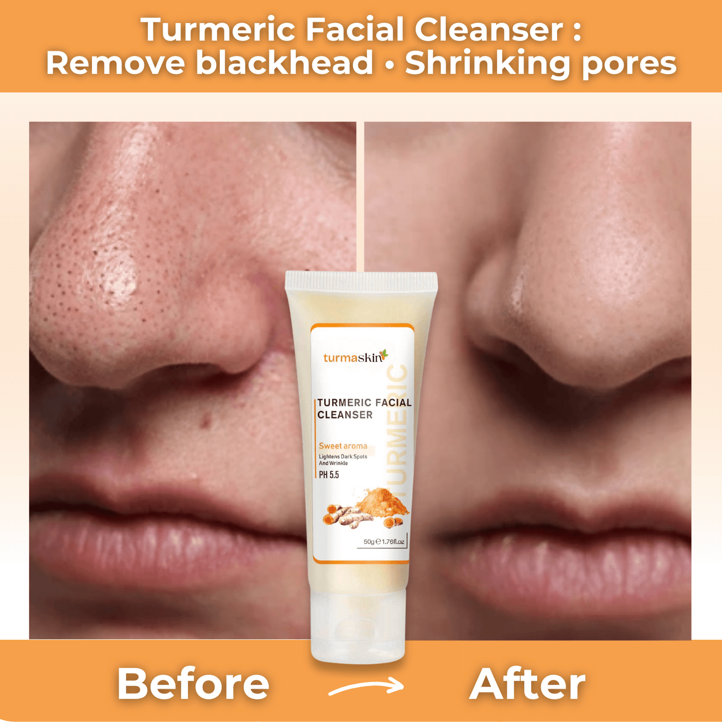 Turmaskin™ Turmeric Facial Cleanser - Turmaskin