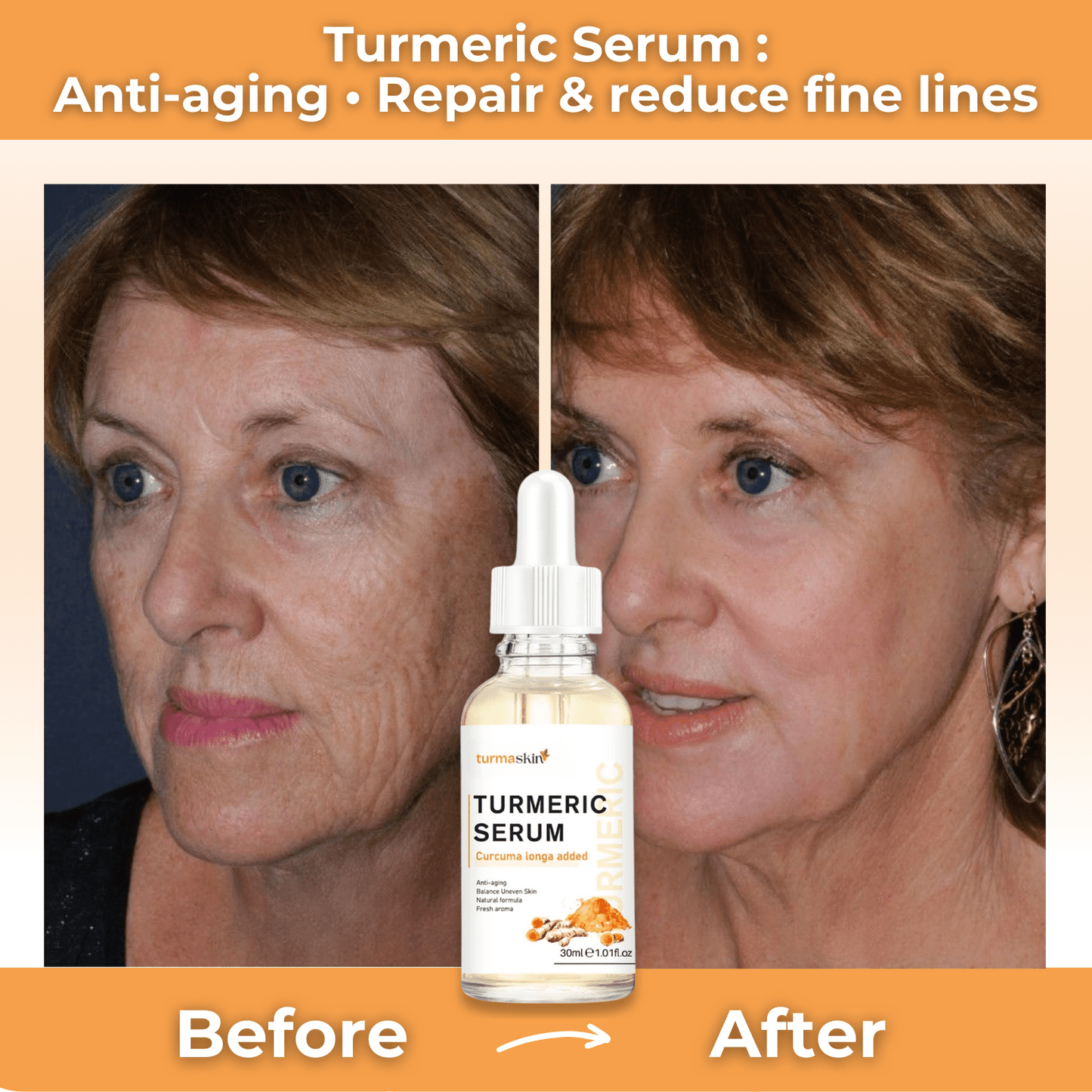 Turmaskin™ Turmeric Serum - Turmaskin