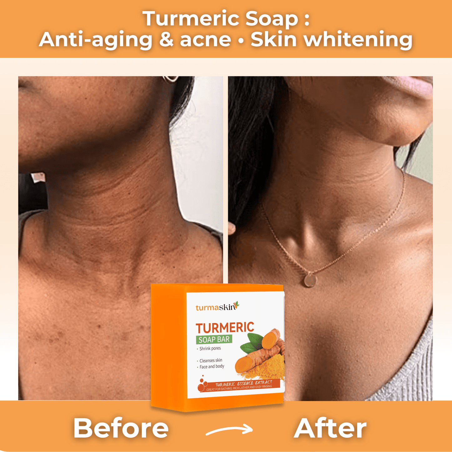 Turmaskin™ Turmeric Soap Bar - Turmaskin